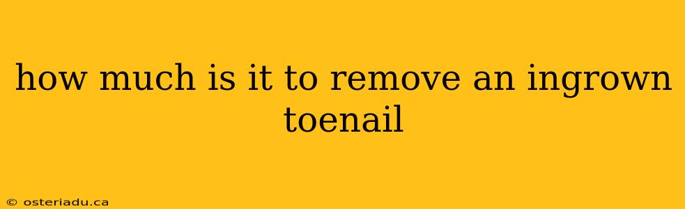 how much is it to remove an ingrown toenail