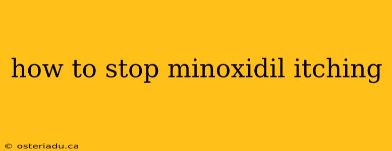 how to stop minoxidil itching